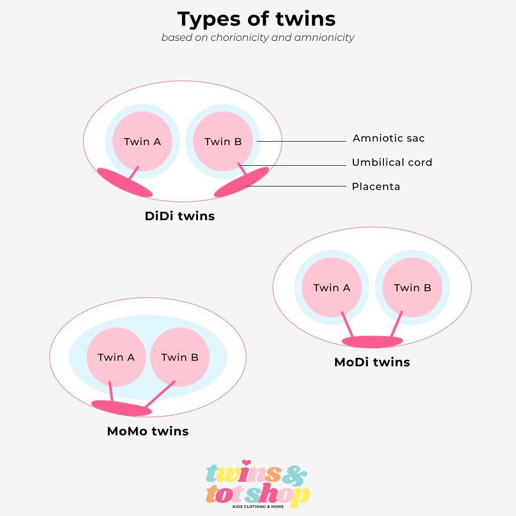 Types of twins based on chorionicity and amnionicity: MoMo, MoDi and DiDi